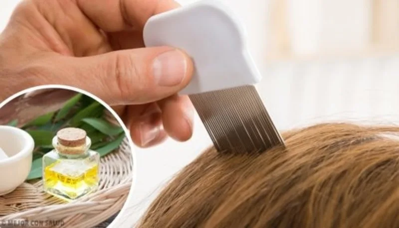 Trattamento naturale contro i pidocchi con olio extravergine di oliva