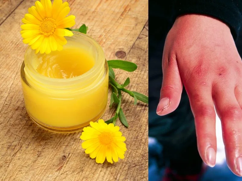 Mani screpolate dal freddo curate con olio extravergine di oliva