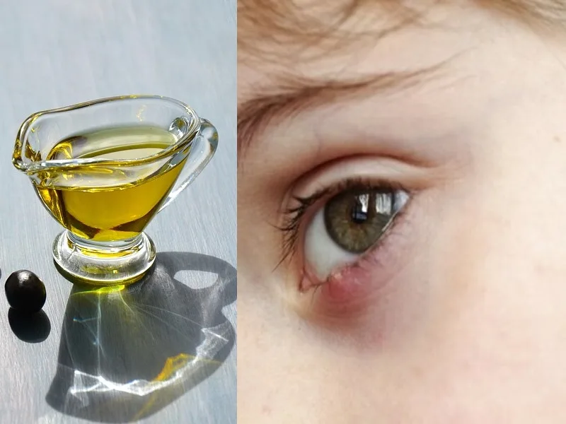 Bottiglia di olio extravergine di oliva accostata a un occhio, simbolo del rimedio naturale contro l'orzaiolo
