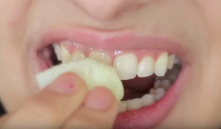 Bottiglia di olio extravergine di oliva accanto a un sorriso, simbolo del rimedio naturale per sbiancare i denti
