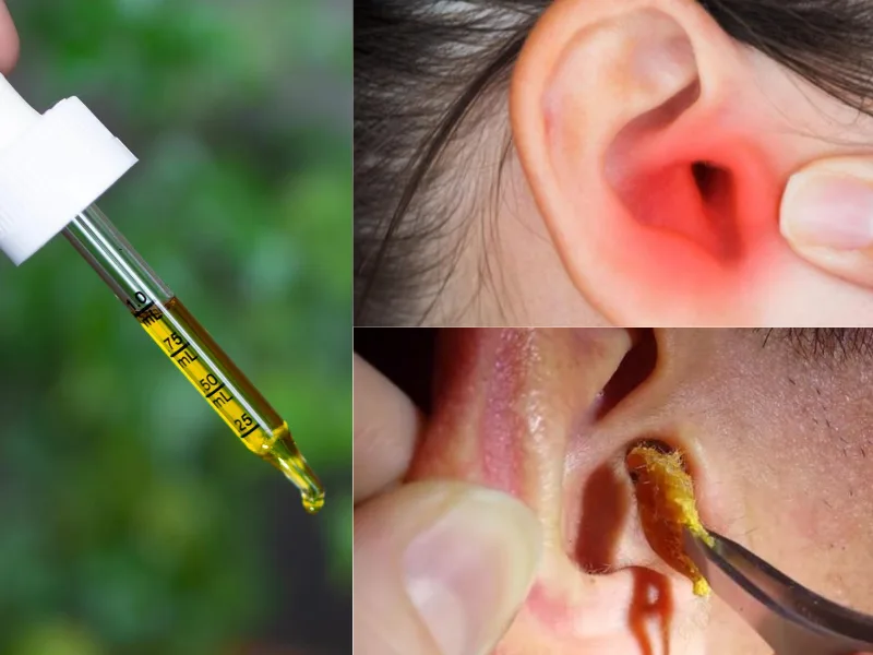 Olio extravergine di oliva versato con contagocce, usato come rimedio naturale per il cerume