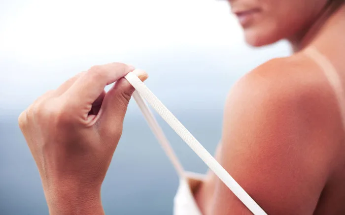 Bottiglia di olio extravergine d'oliva usata come rimedio naturale contro le scottature solari